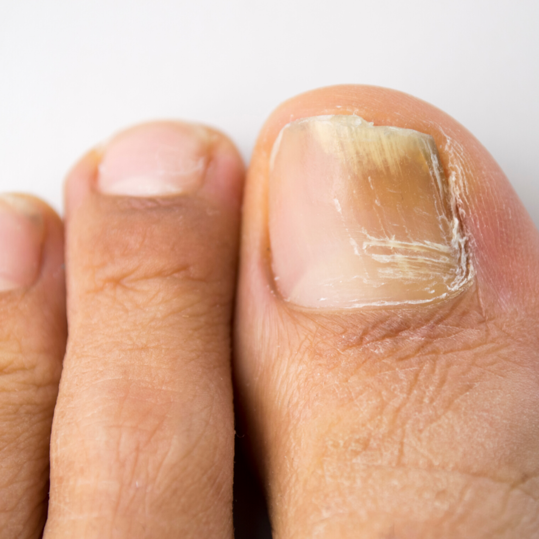 Nail and Skin Care and Podiatry Services from The Melbourne Foot Clinic